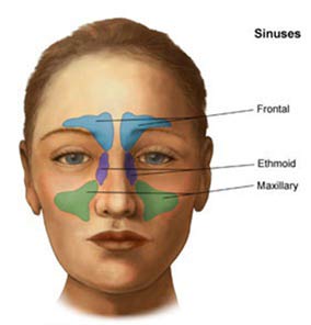 sinusitis Sinus problem & homeopathic treatment