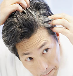 Homeopathic Remedies for Premature Greying Of Hair - homeopathy