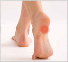 Homeopathic medicines for Calcaneal Spurs