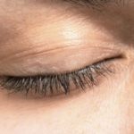 homeopathic remedies for blepharospasm