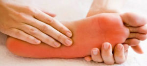 Homeopathic medicines for burning feet 