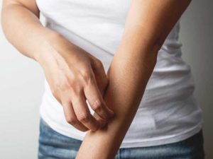 Homeopathic medicines for formication Homeopathic medicines for formication