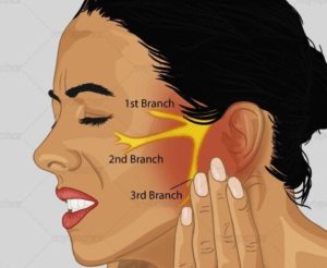 Trigeminal nerve