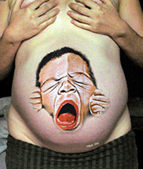 Top 10 Homeopathic Medicines for Gas and Bloating