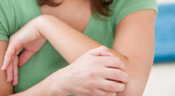 Get Rid of Itching with Natural Homeopathic Medicines