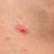 homeopathic treatment for viral infections