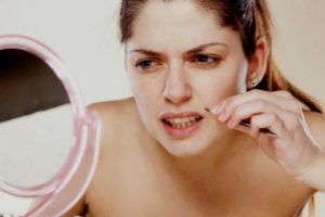 homeopathic medicine for unwanted facial hair - homeopathic medicine