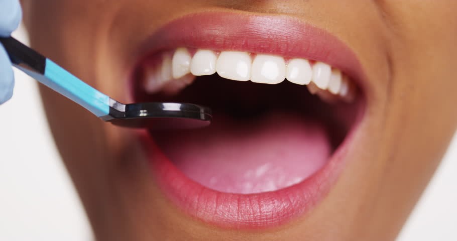 Remove Tonsil Stones Naturally with Homeopathic Remedies
