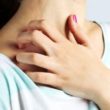 wheat allergy homeopathy