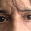 homeopathic medicines for nystagmus