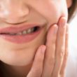 Homeopathic remedies for crania-facial dystonia