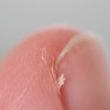 Homeopathic Medicines for Hangnails
