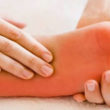 Homeopathic medicines for burning feet
