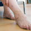 Homeopathy for blood circulation