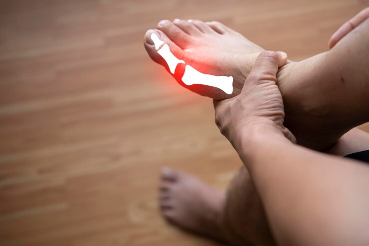 Top 9 Homeopathic Medicines For Toe Pain